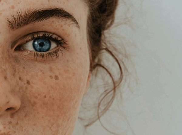 Hautflecken – was tun?